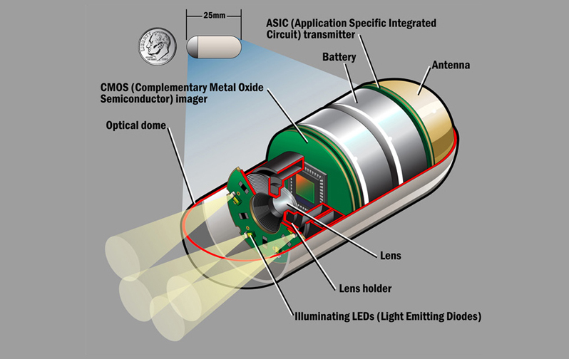 Endoscopic Capsule