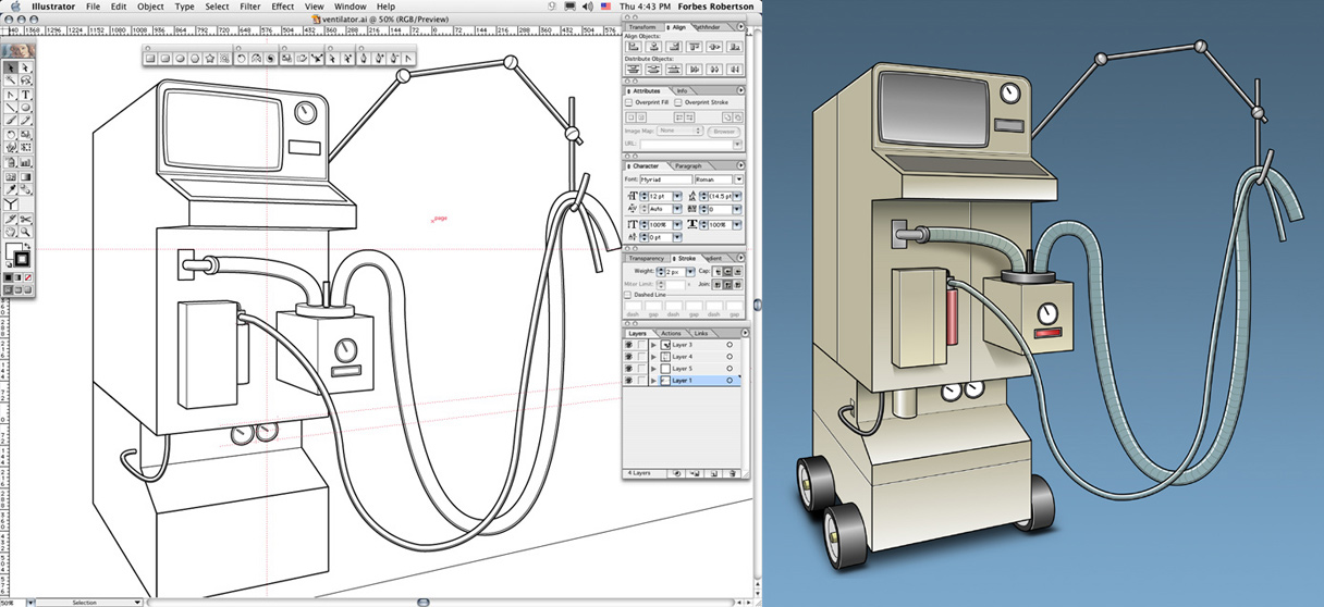 WIP and Final Ventilator
